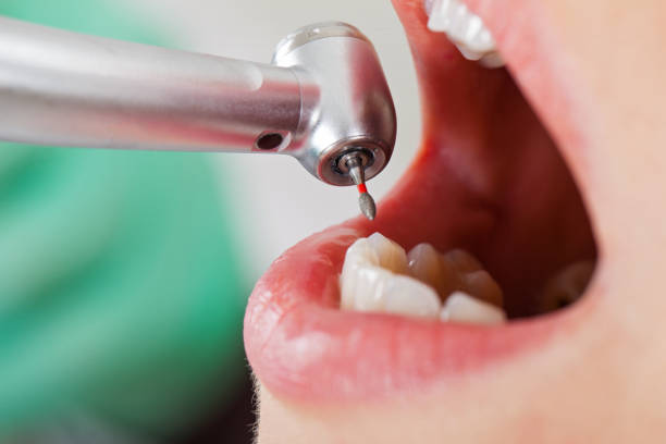 Best Cracked Tooth Emergency Dentist  in Adel, IA